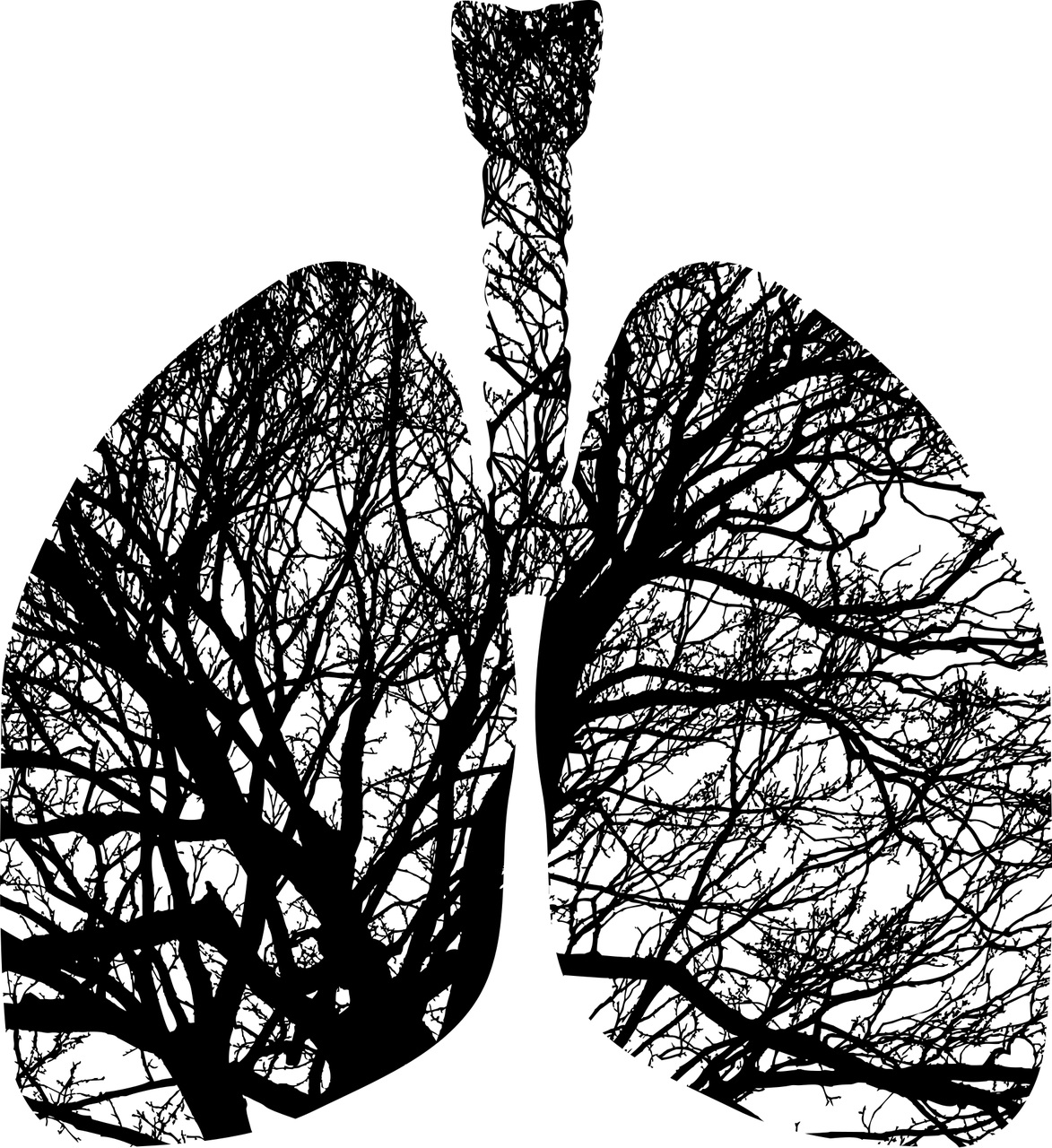 les infections pulmonaires à MNT